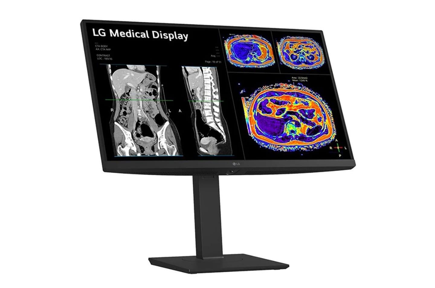 LG 27HS713C-B 27" 8MP IPS Clinical Review Monitor