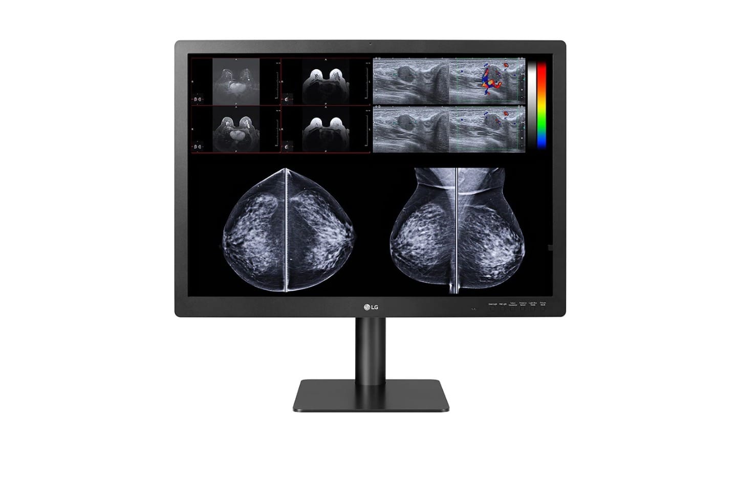 
LG 31HN713D-B 31" 12MP IPS Diagnostic Monitor for Mammography with Multi-resolution Modes, Pathology Mode, Self-calibration, Focus View, PBP and Dual Controller
