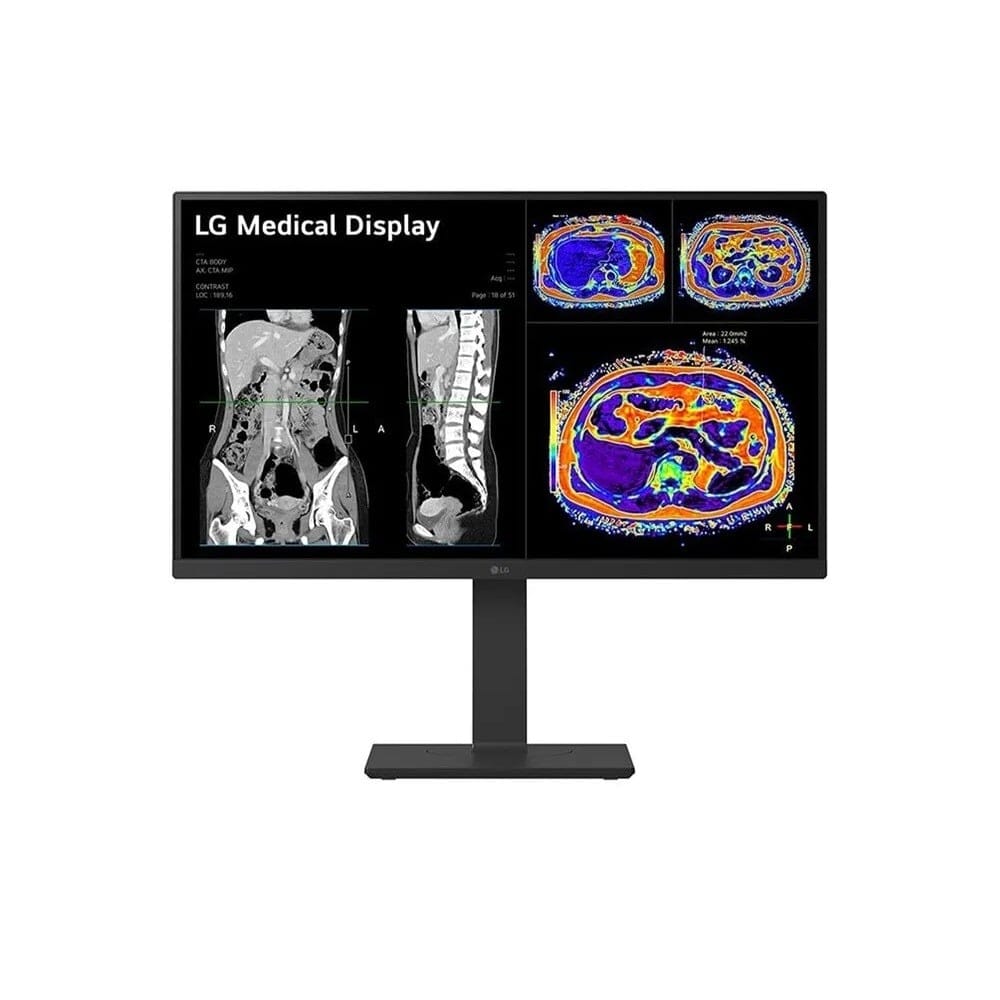 LG 27HS713C-B 27" 8MP IPS Clinical Review Monitor