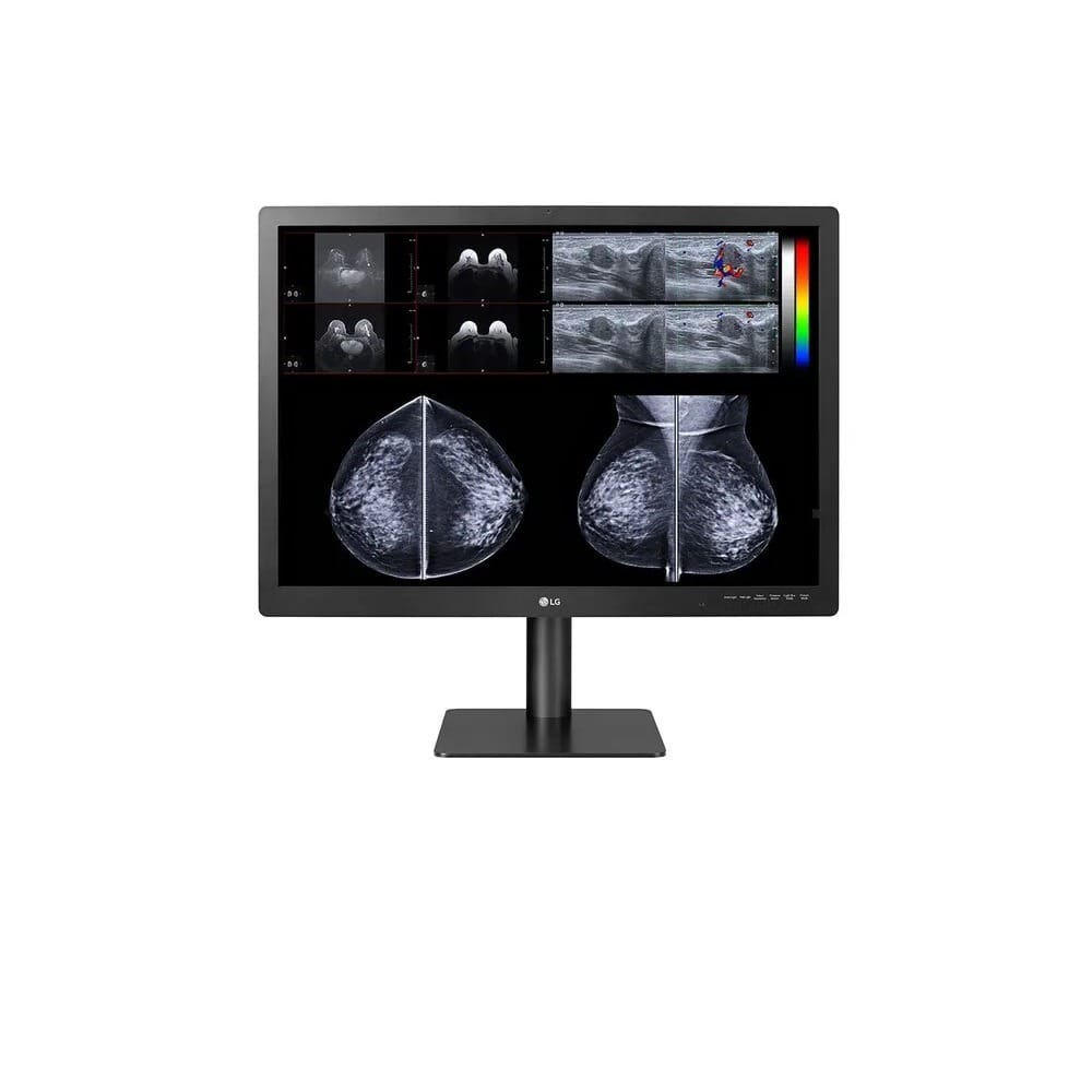 LG 31HN713D-B 31" 12MP IPS Diagnostic Monitor for Mammography with Multi-resolution Modes, Pathology Mode, Self-calibration, Focus View, PBP and Dual Controller