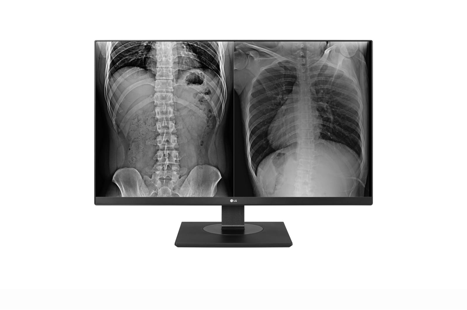 LG LED Display 27" 4K Ultra HD Clinical Review Monitor Black