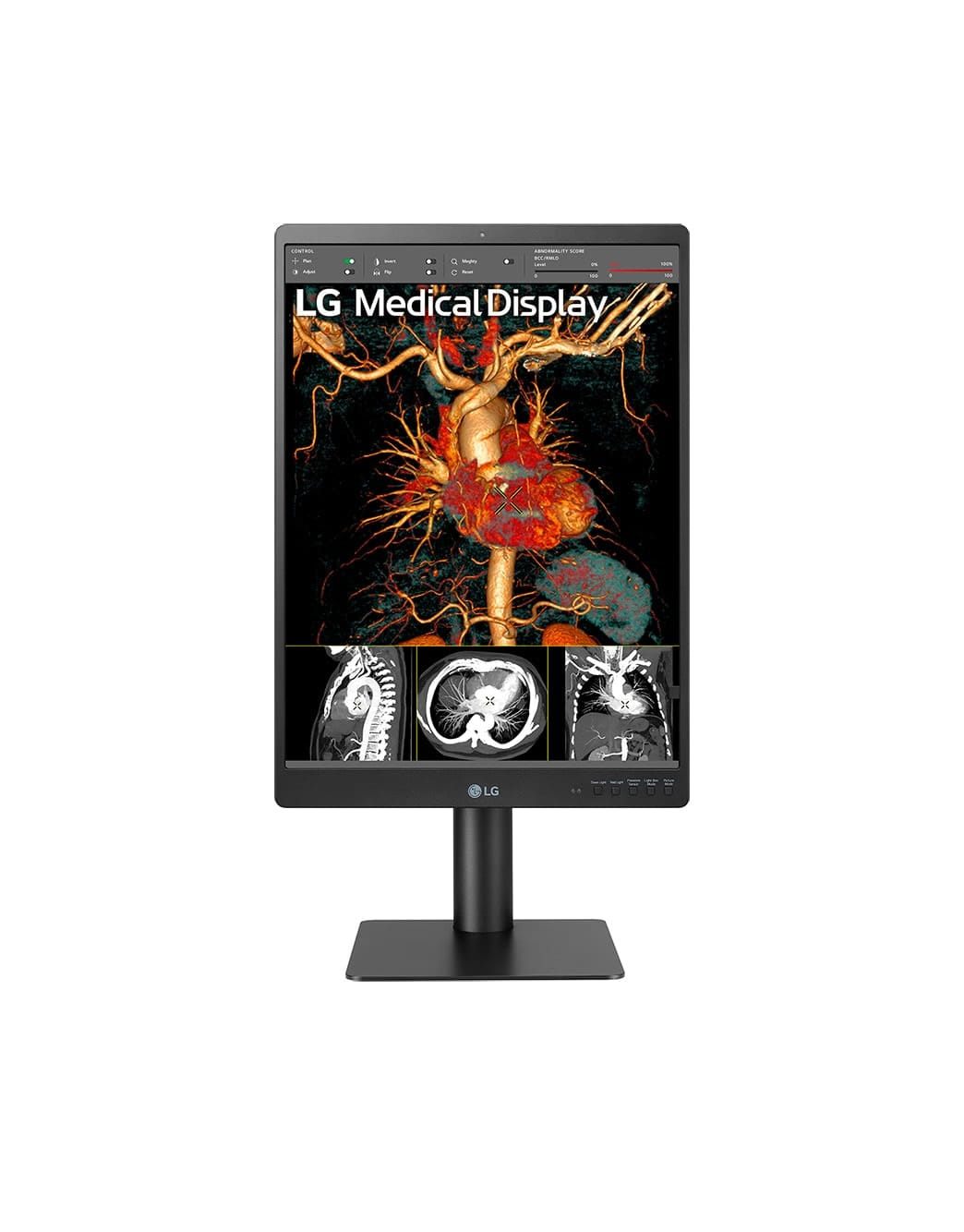 LG 21.3" 3MP IPS Pathology Mode Diagnostic Height Adjustable Monitor