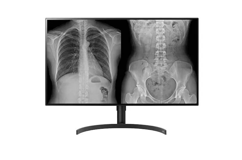 LG 32HL512D-B 32" 4K IPS 8MP Diagnostic Clinical Review Monitor