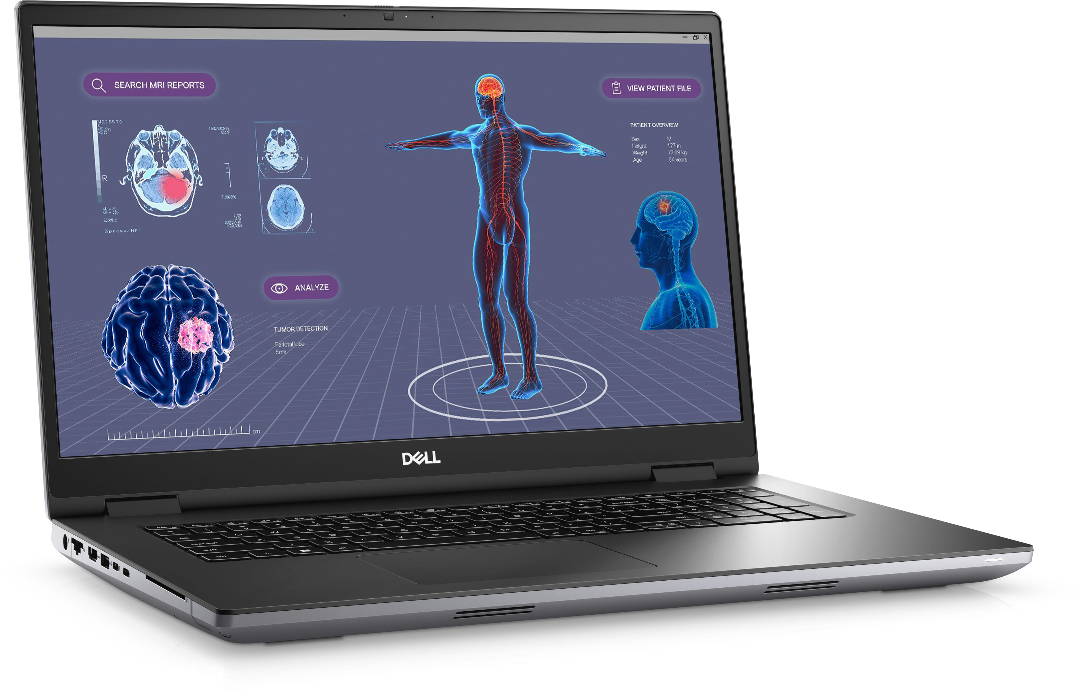 Dell Mobile Precision 7780 17" FHD Laptop, i7, 32GB RAM, 512GB SSD, RTX 3500, Windows 11 Pro